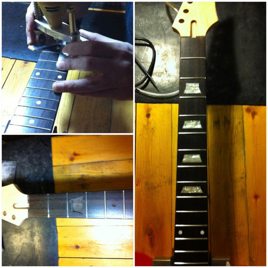 Inlays Replacement