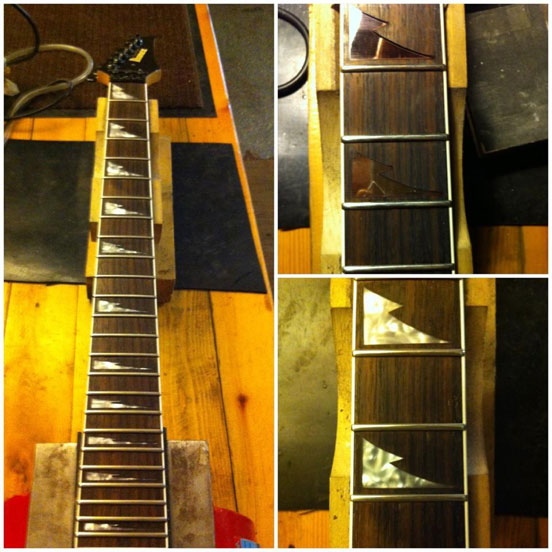 Inlays Replacement